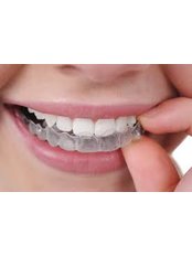 Clear Aligners in Lahore @ ( Smile Line ) - Smile Line - Specialist Dental Surgery