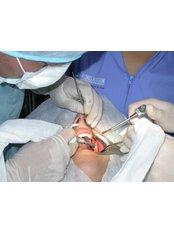 Dental Implants - OdontoFlores Dental Spa