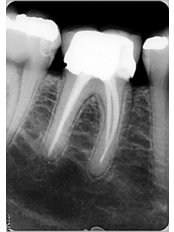 Dental X-Ray - OdontoFlores Dental Spa
