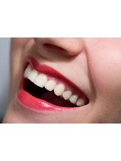 Teeth Whitening - Peru Dental