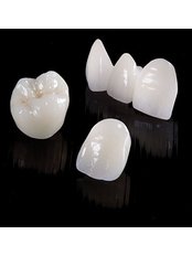 Porcelain Veneers - Peru Dental