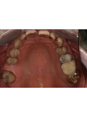 Periodontist Consultation - Peru Dental