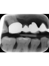 Dental X-Ray - Peru Dental