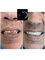 The Dental Clinic & GT Concept Asociados - Av. Benavides 1579, Oficina 504, Torre del Park II, Miraflores, Lima, Peru, 15046,  38