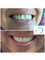 The Dental Clinic & GT Concept Asociados - Av. Benavides 1579, Oficina 504, Torre del Park II, Miraflores, Lima, Peru, Lima 18,  34