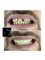 The Dental Clinic & GT Concept Asociados - Av. Benavides 1579, Oficina 504, Torre del Park II, Miraflores, Lima, Peru, 15046,  36
