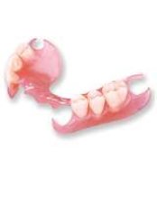 Flexible Partial Dentures - Bonifacio Dental Angeles City Dentist Pampanga PHP