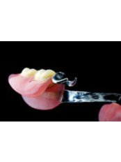 Chrome Dentures - Bonifacio Dental Angeles City Dentist Pampanga PHP