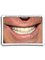 Smile Make Over Dental & Aesthetic Center - We change lives daily with amazing restorations and prosthetics. 