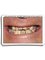 Smile Make Over Dental & Aesthetic Center - Smile Makeover can help even the most difficult dental challenges. 