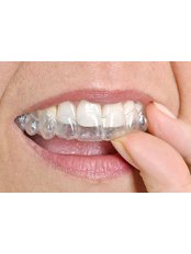 Mouth Guard - Winsome Smile Today