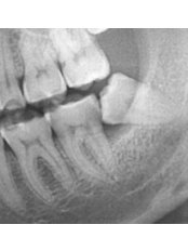 Oral and Maxillofacial Surgeon Consultation - The Dental Hub