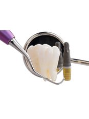 Dental Implants - Premier Dental Care Solutions