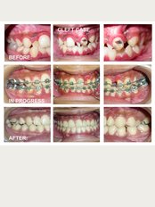 Dental Orthodontic Clinic - GIVE YOURSELF A GOOD SMILE