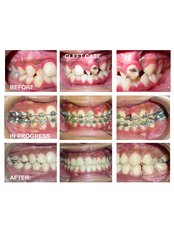 Dental Orthodontic Clinic - GIVE YOURSELF A GOOD SMILE 