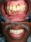 Bel-Air Dental Care - Periodontal Treatment 