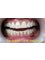Maximo A. Lim Dental Clinic - Rm. 309 Sanda Bldg, A.H. Lacson St., corner  Laon Laan St., Sampaloc, Manila, Philippines, 1008,  14