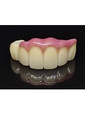 Dental Bridges - Flores Dental PH