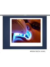 Laser Teeth Whitening - Dental Clinic - Dr. Deborah Manugas-Ramos