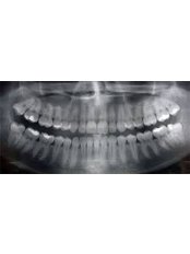 Digitales Panorama-Zahnröntgen - Victoria Clinic