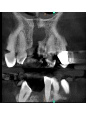 3D Dental X-Ray - Artdentina