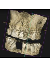 3D Dental X-Ray - Artdentina