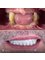 Jesionowa Dental Clinic - Case Study 7 - All on Vertical 4 