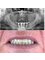 Jesionowa Dental Clinic - Case study 3 - All on 4 X-ray 