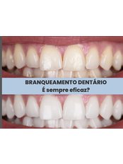 Teeth Whitening - Clínica Dr. António Bexiga