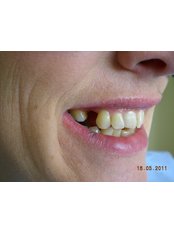 Implant Dentist Consultation - Maia Clinic