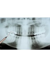 Digital Panoramic Dental X-Ray - Vita Centro Implantologia Setúbal