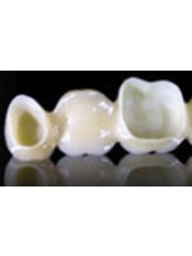 Dental Crowns - Vita Centro Implantologia Setúbal