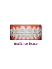 Clear Braces - Radionic Company Dental Clinic