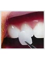 Cosmetic Dentist Consultation - CENTRUL STOMATOLOGIC ZORILOR- DR.TUDOR POMANA