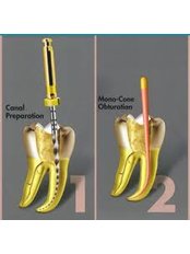 Endodontist Consultation - CENTRUL STOMATOLOGIC ZORILOR- DR.TUDOR POMANA