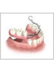 Chrome Dentures - CENTRUL STOMATOLOGIC ZORILOR- DR.TUDOR POMANA