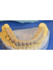 Dental Bridges - ImplantFix Clinic: Dr. Ilie-Dan Sabin