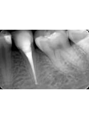 Dental X-Ray - Dental-Art Oradea