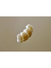 Porcelain Crown - Pomadent Dental Clinic