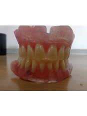 Dentures - DentalTech dental labor romania