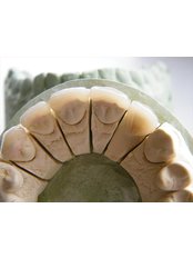 Veneers - DentalTech dental labor romania