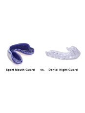 Mouth Guard - Beo Smile Design