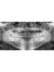 Panoramic Dental X-Ray - Beo Smile Design