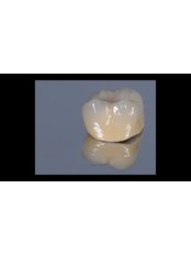 Zirconia Crown - Center for Dental Esthetic and Implantology
