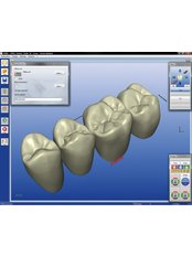 CEREC Dental Restorations - Center for Dental Esthetic and Implantology