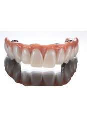 Dental Bridges - Gentle Touch Dental Studio