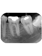 Dental X-Ray - MyDentist