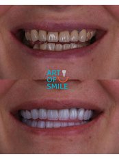 Dentist Consultation - Art Of Smile DSD