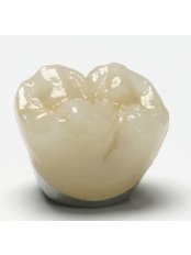 Dental Crowns - Dental Clinic 