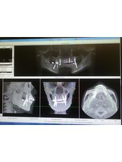 3D Dental X-Ray - B9 Dental Centre - The Star Vista